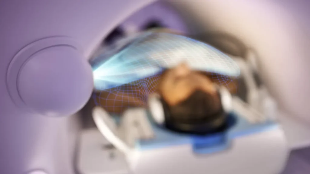 Radiologie Marktredwitz - Prostata-MRT